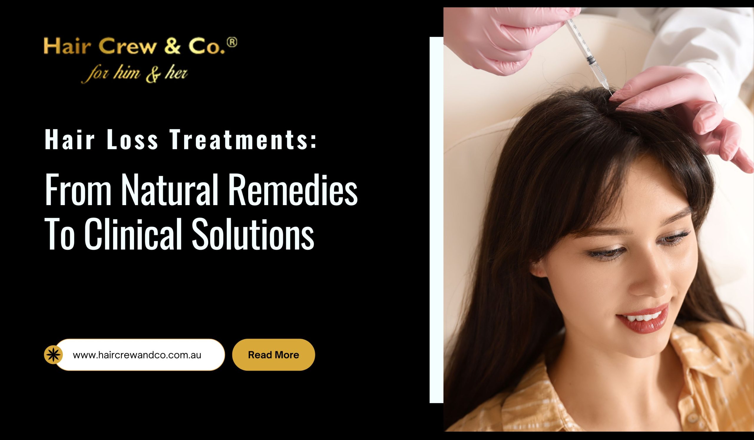 Hair Loss Treatments